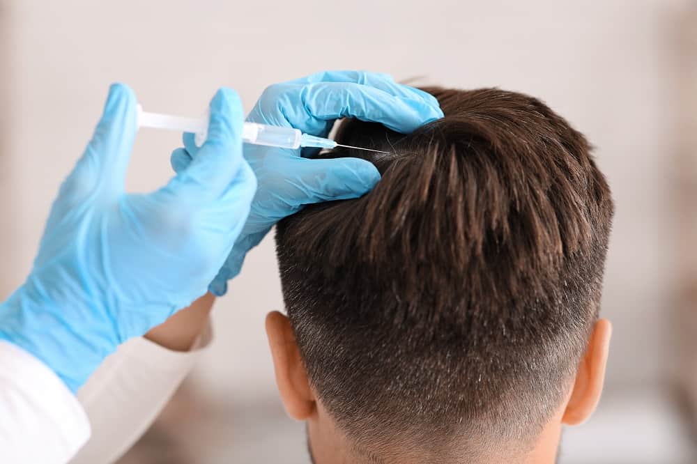 Hair Transplant Treatment