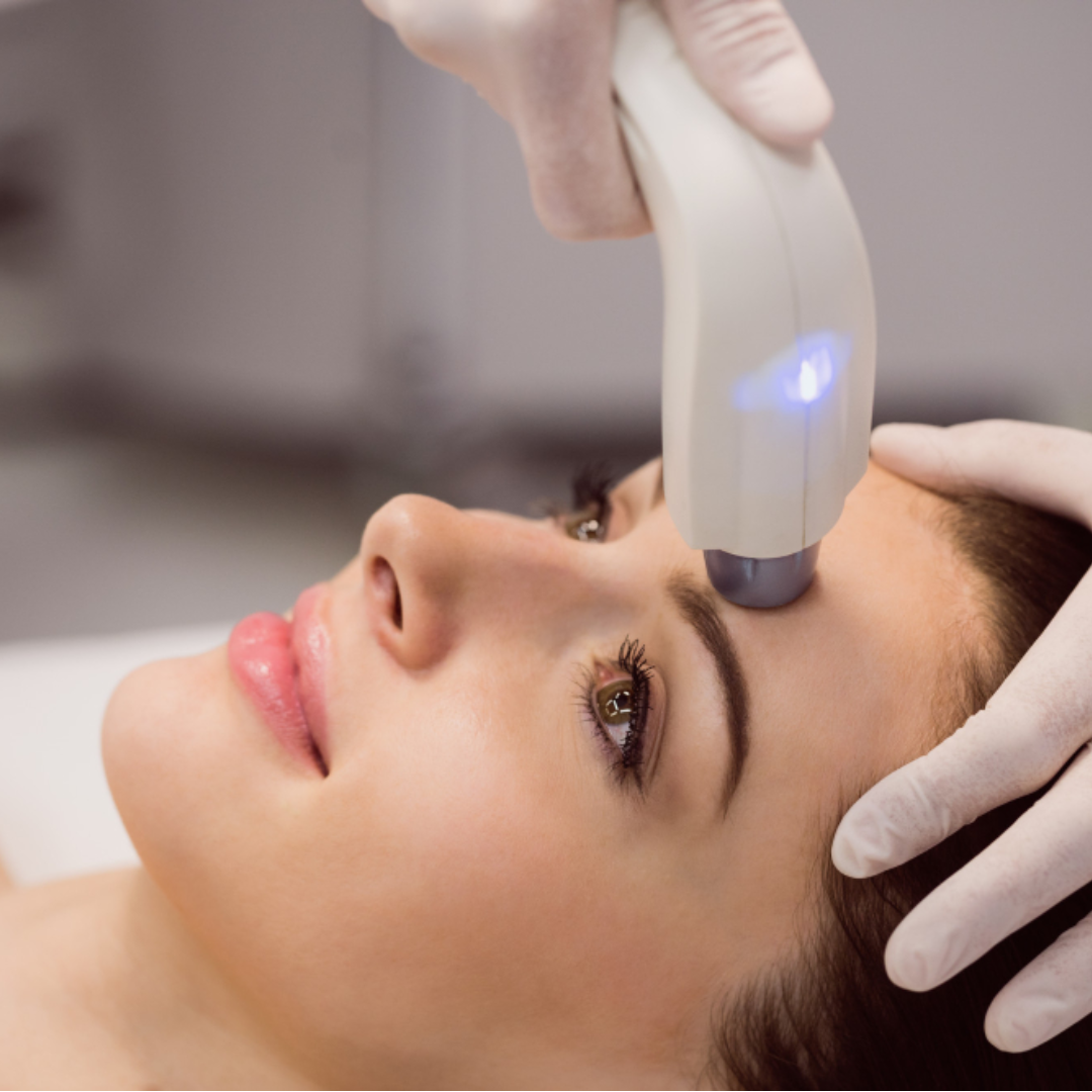 Laser Treatment